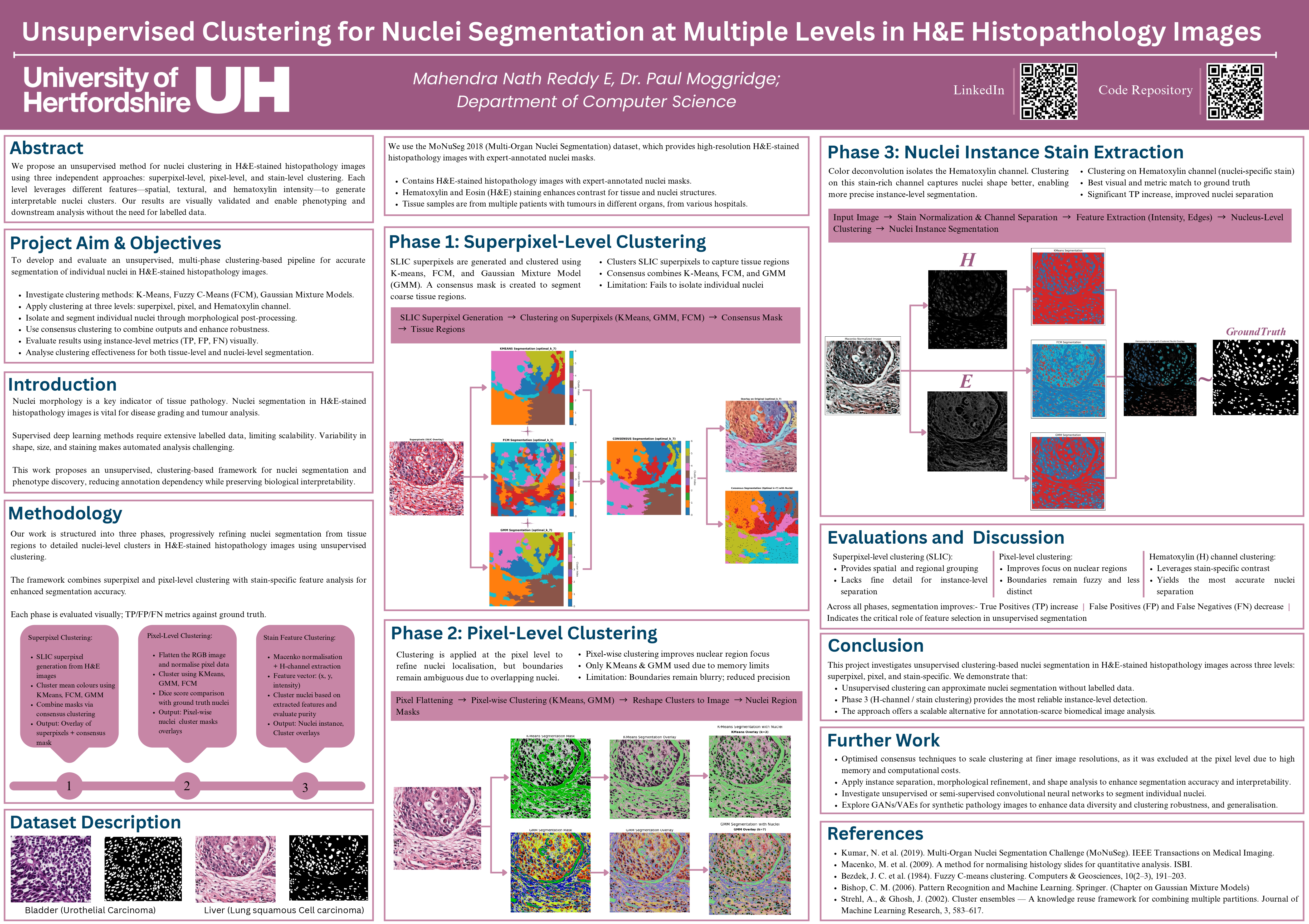 Research poster on unsupervised nuclei segmentation